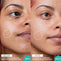 Before and after image of someone using Retinol & rainbow Algae Serum